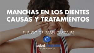 Manchas decoloración en los dientes