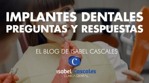 Implantes dentales preguntas y respuestas